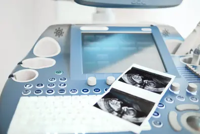 Ultrasonografi
