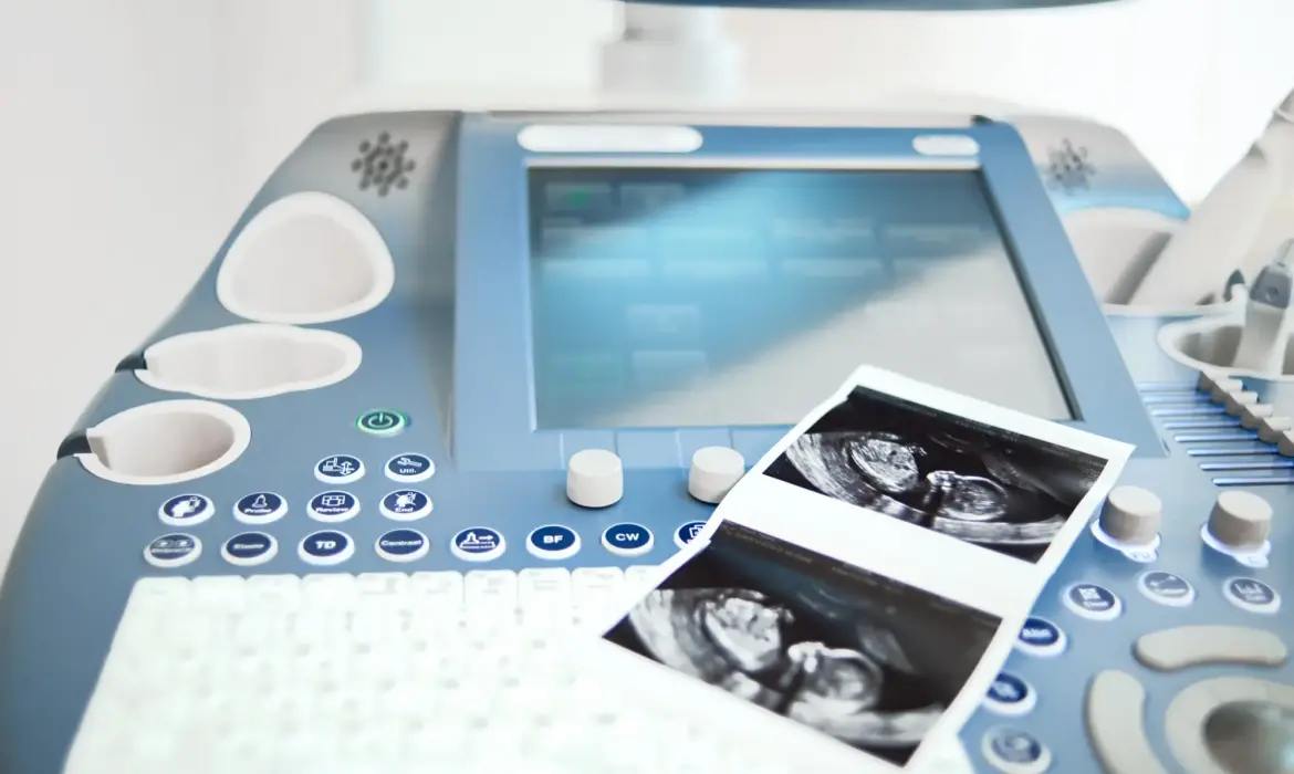 Ultrasonografi